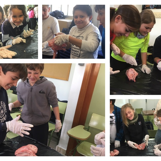 2016-11-09_DISECCION OJO CORDERO (46)