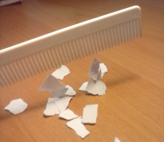 Electricidad estática.