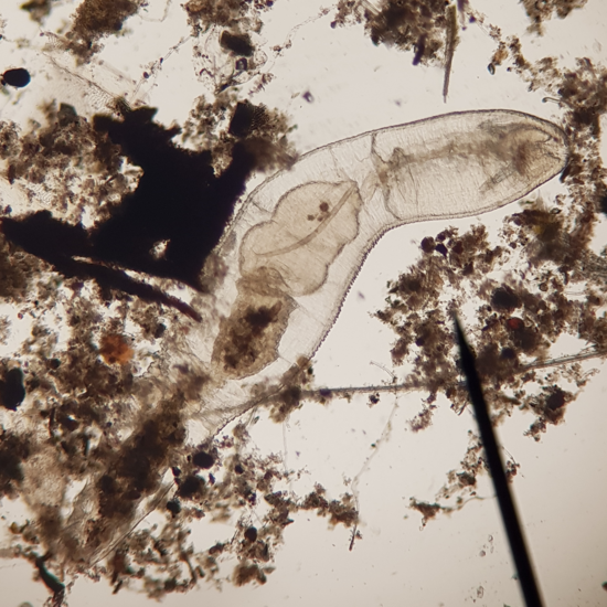 Oligoqueto chaetogaster