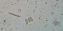 Nitzschia diatomea