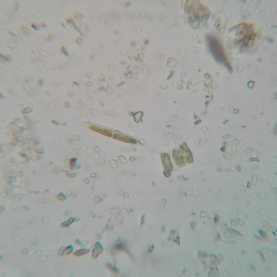 Nitzschia diatomea