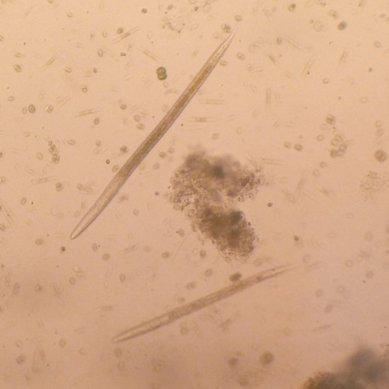 Synedra_Ulna-Nazop-L-01-01