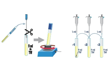 Muestreo y tratamiento. Diluciones