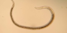 Nematodo monhystera filiformis