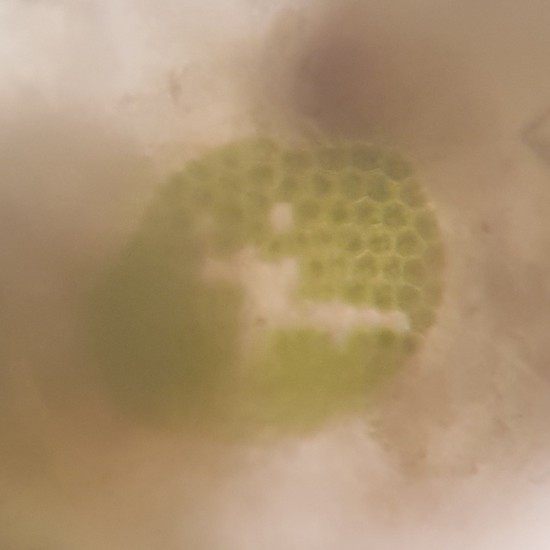 Cianobacteria_colonia_nostoc