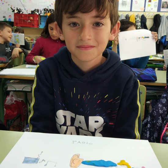 Día Internacional del Implante Coclear - ¿Cómo funciona un implante? 8