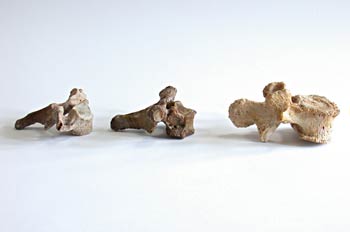 Vista lateral de la vértebra cervical, torácica y lumbar