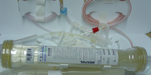Set de hemofiltración
