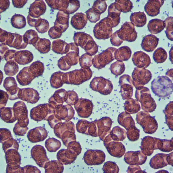 Células sanguíneas 3