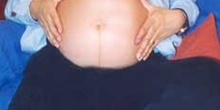 Mujer embarazada