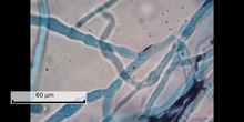 Práctica: Observación de micelios de mohos teñidos con lactofenol