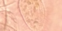 Paramecium_Trichium-Nazop-L-01-01