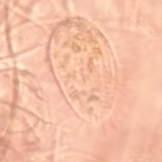 Paramecium_Trichium-Nazop-L-01-01