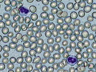 Práctica de Frotis sanguíneo 8