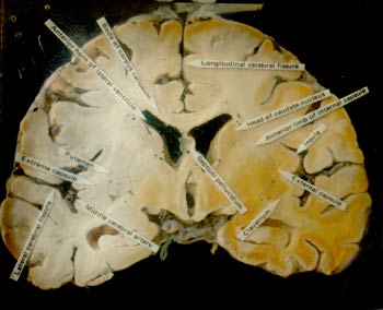 Sección del  cerebro