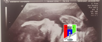 Embarazo y parto de Piero