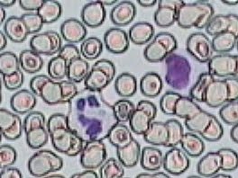 Práctica de Frotis sanguíneo 18