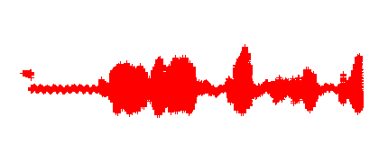 Thyrotoxicose