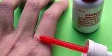 Desinfectar una herida