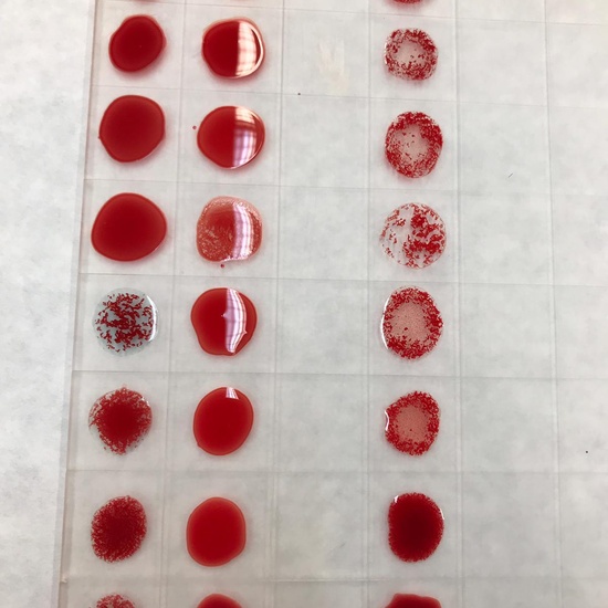 VISITA CENTRO DE TRANSFUSIÓN DE SANGRE 12