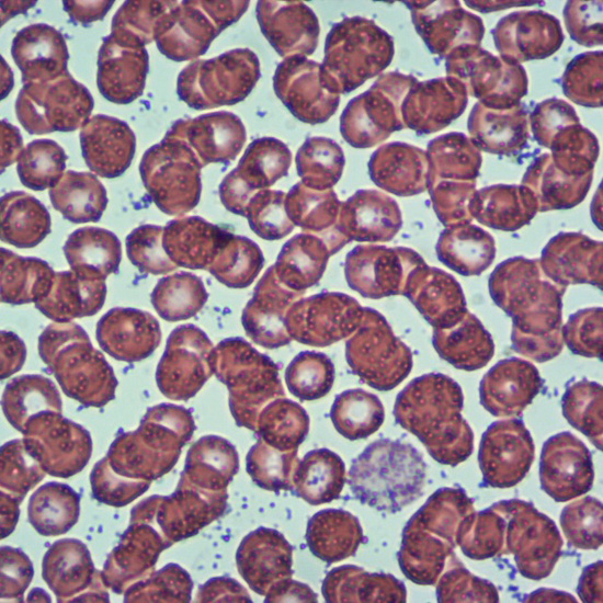 Células sanguíneas 4