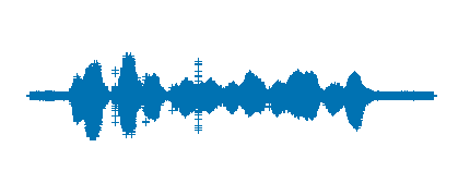 Carlos Diego 1B. Concurso radio 2022