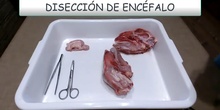 DISECCIÓN DE ENCÉFALO