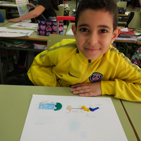 Día Internacional del Implante Coclear - ¿Cómo funciona un implante? 11