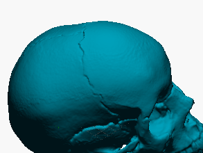 Cráneo humano (modelo anatómico escaneado)