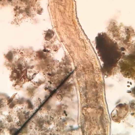 Cerva-L-03-01-OLIGOQUETO1 (2018-12-16)