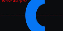 Lente menisco divergente