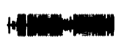 DISTORSION EN LAS ONDAS 16 DE NOVIEMBRE