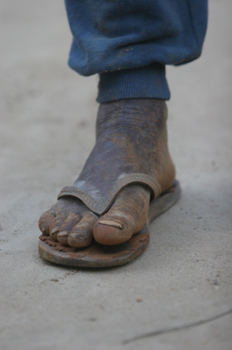 Pie de un vecino de Quilombo, Sao Paulo, Brasil