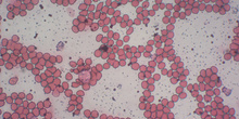 Células sanguíneas 6
