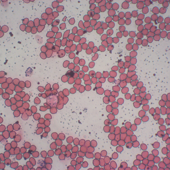 Células sanguíneas 6