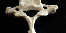 Vértebra cervical