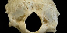 Occipital