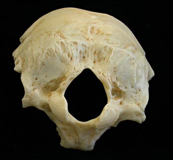 Occipital