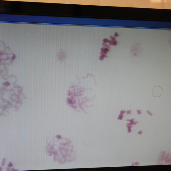 Meiosis de saltamontes