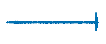 LA RADIO - Dos dedos de frente