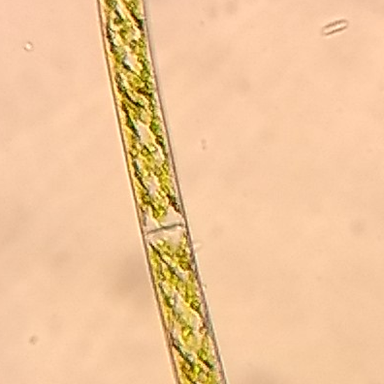 Zygnematales sprirogyra