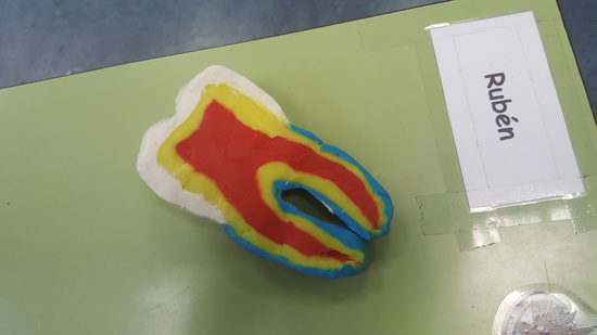 Charla prevención de caries 1