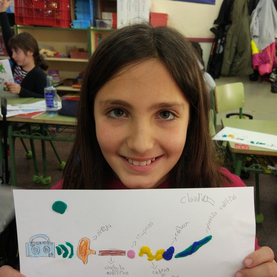 Día Internacional del Implante Coclear - ¿Cómo funciona un implante? 7