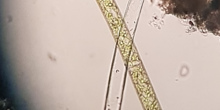 Cerva-R01-01 (Spirogyra)