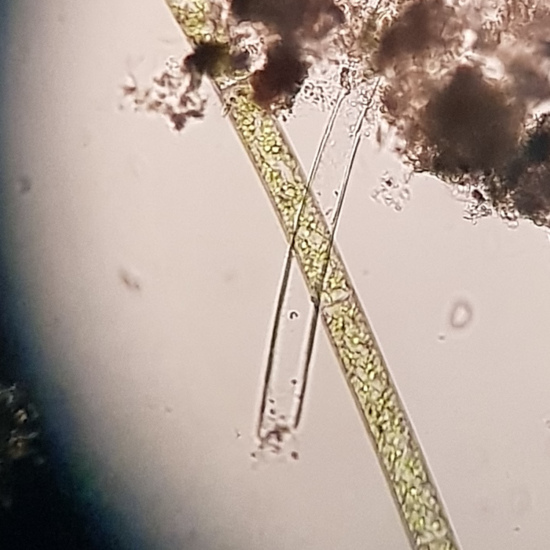 Cerva-R01-01 (Spirogyra)