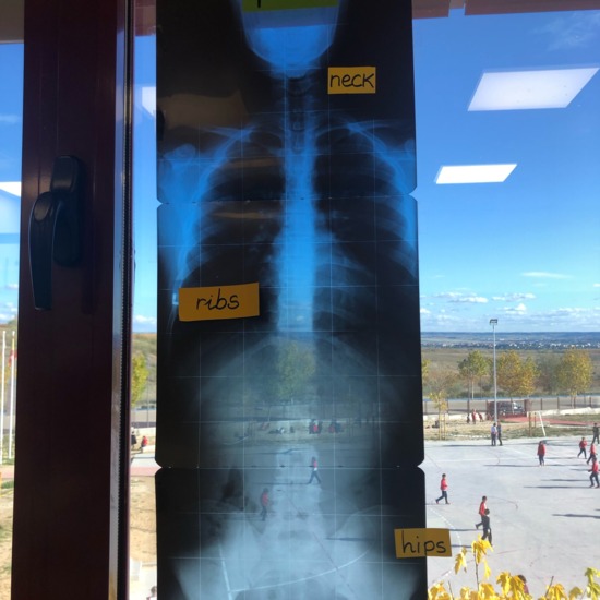 X ray Body