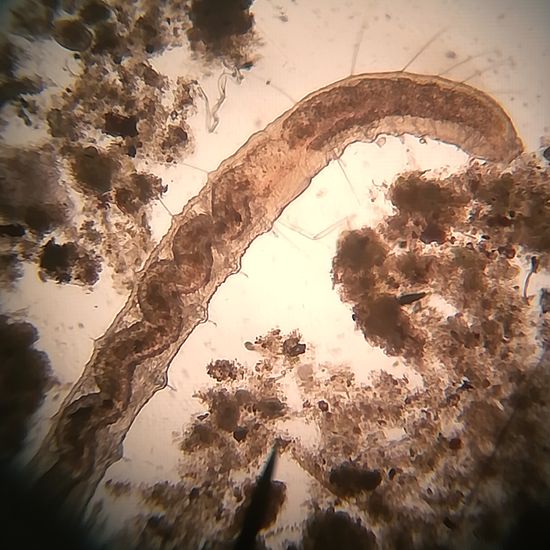 Cerva-L-03-01-01-oligoqueto_chaetogaster