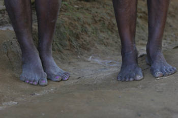 Pies de una vecina de Quilombo, Sao Paulo, Brasil