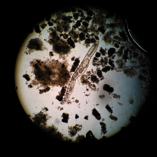 Nais_elinguis-Nazop-L-01-03-IG