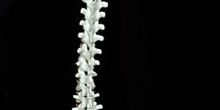 Columna Vertebral y Cadera